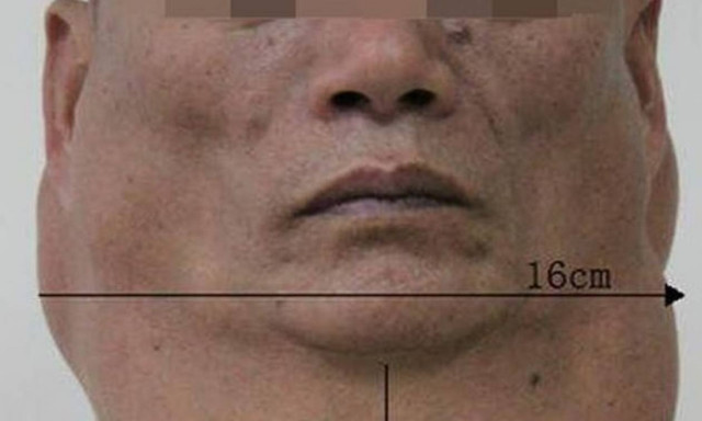 Πίνετε πολύ; Μετά από αυτό σίγουρα θα το ξανασκεφτείτε! (photos)