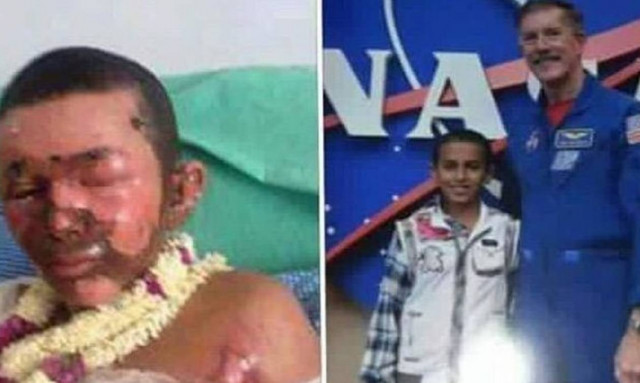 Υεμένη: Παιδί-θαύμα θύμα του παραλογισμού (video)