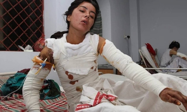 Πακιστάν: Την έκαψε γιατί απέρριψε την πρόταση γάμου