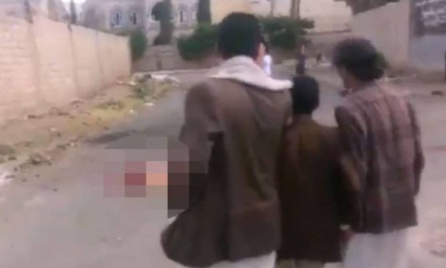 Σκληρό βίντεο: Τζιχαντιστής καμικάζι κόπηκε στα δύο μετά από αποτυχημένη επίθεση αυτοκτονίας