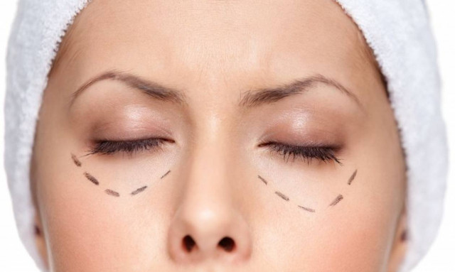 Βλεφαροπλαστική για ανανεωμένο και ξεκούραστο Βλέμμα