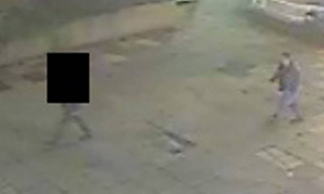 Σοκαριστικές εικόνες: Έκανε τον επίδοξο βιαστή της να μοιάζει με το τέρας του… Φρανκεστάιν (photos)