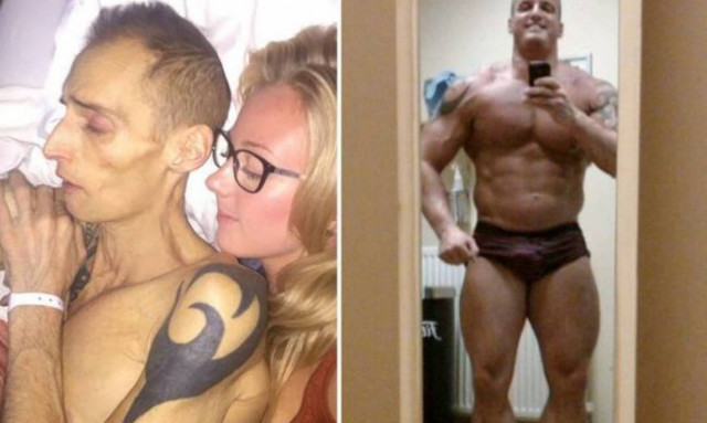 Δείτε πώς έγινε 39χρονος bodybuilder από χρήση αναβολικών