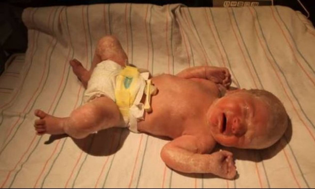 Δείτε πώς γίνεται το τεστ APGAR στα νεογέννητα (vid)