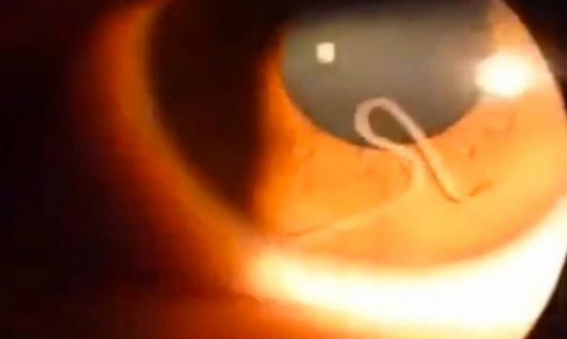 Ανατριχιαστικό! Κοίταξε μέσα στο μάτι της και είδε κάτι ζωντανό και επικίνδυνο (video)