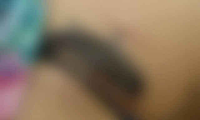 Απίστευτο: Κολυμπούσε και της καρφώθηκε ένα γατόψαρο στο στομάχι (Pics & Vid)