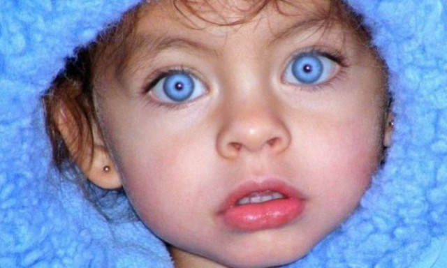 Τι είναι το ρετινοβλάστωμα και σε ποια ηλικία εμφανίζεται;