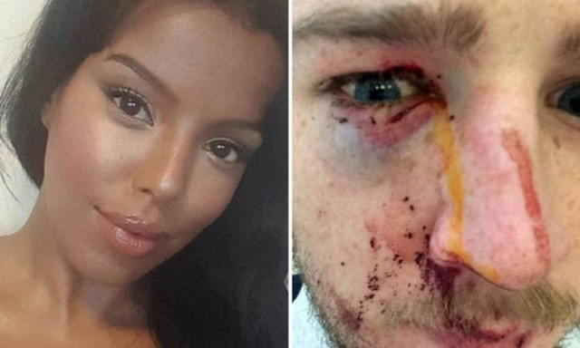 Βρετανία: Τον κάρφωσε στο μάτι με γόβα στιλέτο (pics+vid)