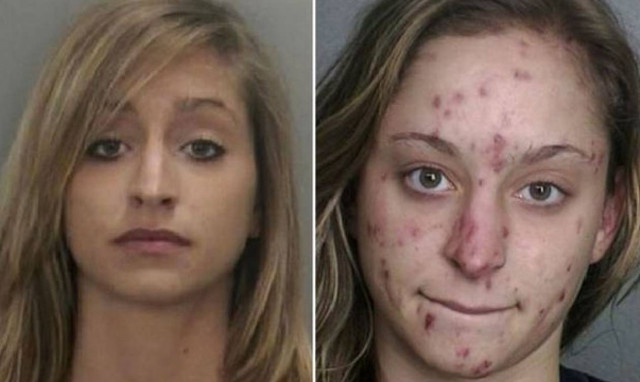 Συγκλονιστικές εικόνες: Η μεταμόρφωση των χρηστών κρυσταλλικής μεθαδόνης (video+photos)