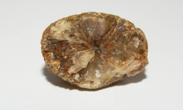 Πέτρες στη χολή: Ποιοι κινδυνεύουν περισσότερο - Τι θα συμβεί αν δεν τις αφαιρέσετε