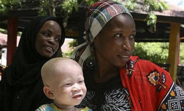 Φρίκη στο Μπουρούντι: Διαμέλισαν 5χρονο κοριτσάκι που έπασχε από αλφισμό