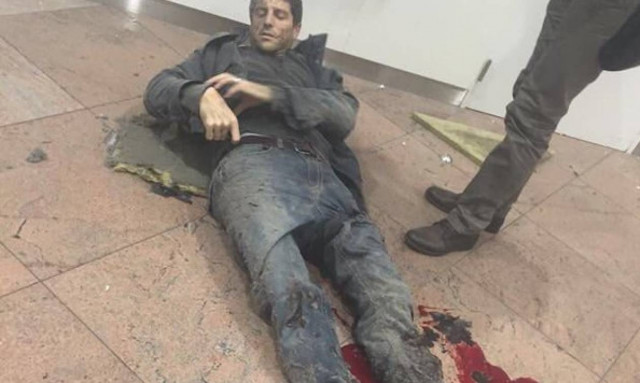 Εκρήξεις στο αεροδρόμιο των Βρυξελλών: Σοκ προκαλούν οι φωτογραφίες των τραυματιών (pics)