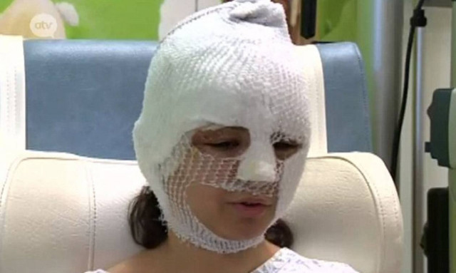 Συγκλονιστική μαρτυρία τραυματία στις Βρυξέλλες: «Ήταν σαν το τέλος του κόσμου» (pic+vid)