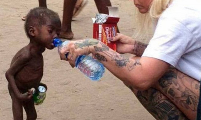 Και όμως υπάρχει ελπίδα: Το θαύμα της μεταμόρφωσης του αγοριού που βρέθηκε υποσιτισμένο στη Νιγηρία