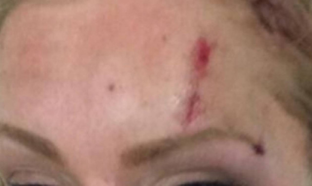 Δράμα... Ελληνίδα παρουσιάστρια κακοποιείται από τον άνδρα της