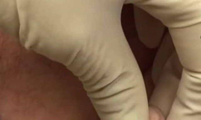 Ένας μικρός… εγκέφαλος μεγάλωνε για 8 χρόνια στο πόδι του! Αντέχετε να δείτε τι ήταν; (photos+video)