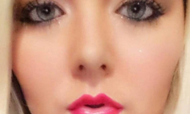 Νοσοκόμα έκανε για χρόνια αλόγιστη χρήση σολάριουμ - Δείτε τη σοκαριστική παραμόρφωσή της! (pics)