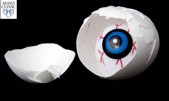 Κόκκινα μάτια: Τι προκαλεί το ενοχλητικό σύμπτωμα (λίστα)