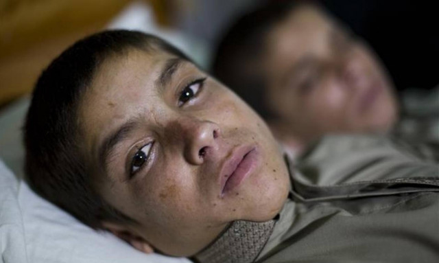 Απίστευτο: Τη μέρα είναι δυο φυσιολογικά παιδιά, το βράδυ όμως…(pics)