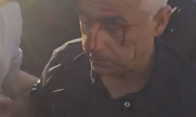 Επεισόδια έξω από τη Βουλή - Άγνωστοι επιτέθηκαν σε αγροτοσυνδικαλιστή (vid+pics)