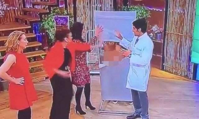 Χαμός στο πρωινό: Μοντέλο λιποθύμησε στον αέρα με το στήθος έξω! (video)