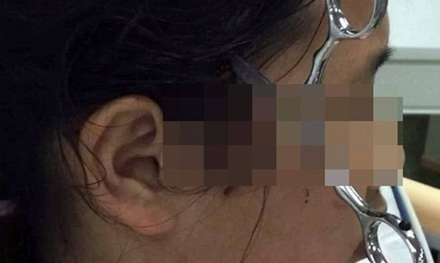 Πατέρας κάρφωσε ψαλίδι στο κεφάλι της κόρης του επειδή δεν διάβαζε! (ΠΡΟΣΟΧΗ ΣΚΛΗΡΕΣ ΕΙΚΟΝΕΣ)