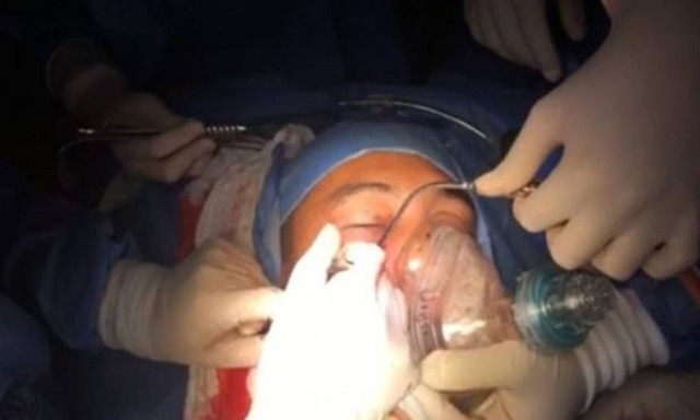 Βίντεο που κόβει την ανάσα: Αφαιρούν ενεργή χειροβομβίδα από το κρανίο στρατιώτη! (ΣΚΛΗΡΕΣ ΕΙΚΟΝΕΣ)