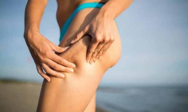 Διατροφικές και άλλες συμβουλές για την κυτταρίτιδα