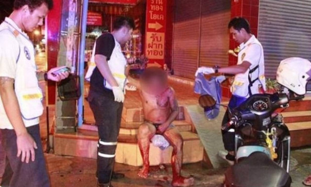 Φρικιαστική εκδίκηση: Απατημένη σύζυγος έβαλε παγίδα για σεξ και του έκανε το πέος κομματάκια! (pic)