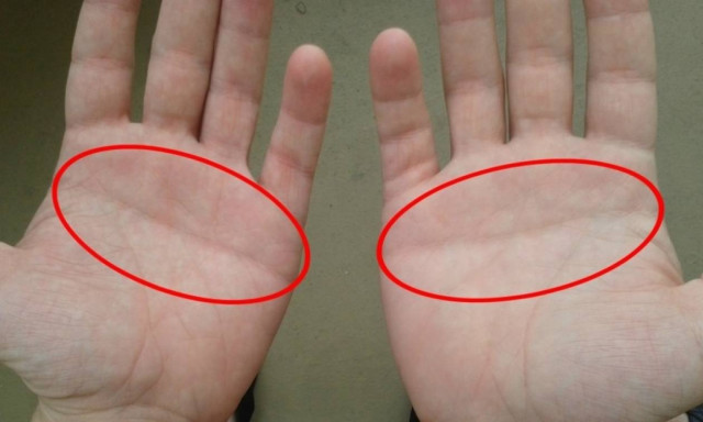 Μόλις το 10% του πληθυσμού έχει αυτή τη γραμμή στην παλάμη του - Δες τι σημαίνει!