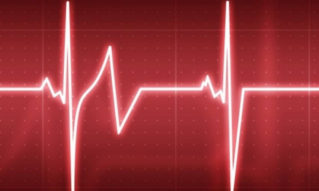 Ποιο είδος μουσικής πρέπει να ακούτε αν έχετε... υπέρταση!