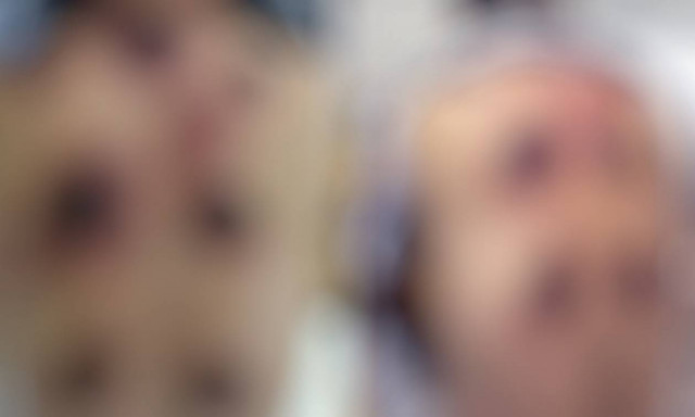 Η πλάτη του πρήστηκε και γέμισε τεράστιες τρύπες - Δεν φαντάζεστε από τι.... (Σκληρές εικόνες)