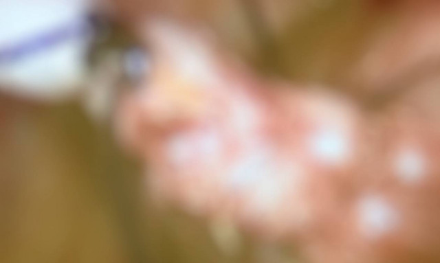 Παραπονιόταν για φρικτούς πόνους στην κοιλιά: Δεν φαντάζεστε τι βρήκαν μέσα της οι γιατροί (vid)