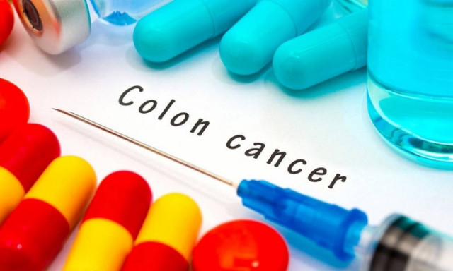 Θάνατος από καρκίνο του εντέρου: Η διατροφή που μειώνει κατά 70% τον κίνδυνο