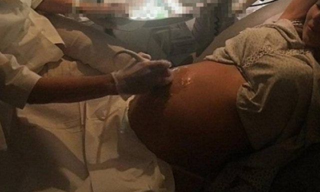 Για υπέρηχο λίγους μήνες πριν γεννήσει