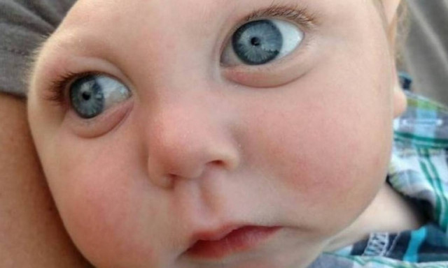 Συναγερμός στις ΗΠΑ: Βρέφος πέθανε στο Τέξας από τον ιό Ζίκα