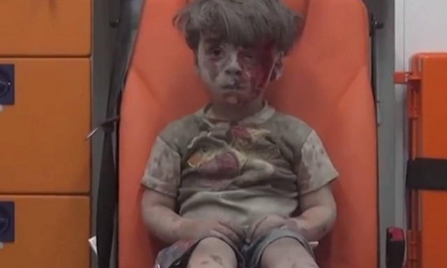 Πέθανε ο αδερφός του μικρού Ομράν που είχε γίνει viral στα social media