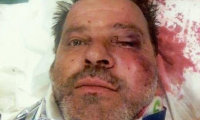 Πρωτοφανής επίθεση εναντίον εργαζομένου της ΔΕΗ στη Ζάκυνθο