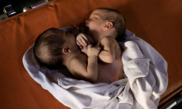 Συρία: Έχασαν την μάχη με τη ζωή τα σιαμαία αδελφάκια που γεννήθηκαν σε πεδίο μάχης