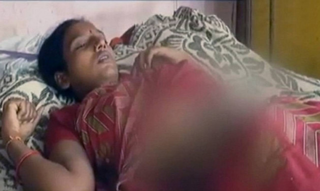 Φρίκη: Πεθερά έριξε οξύ στην έγκυο νύφη της επειδή δεν ήθελε να κάνει άλλη κόρη!