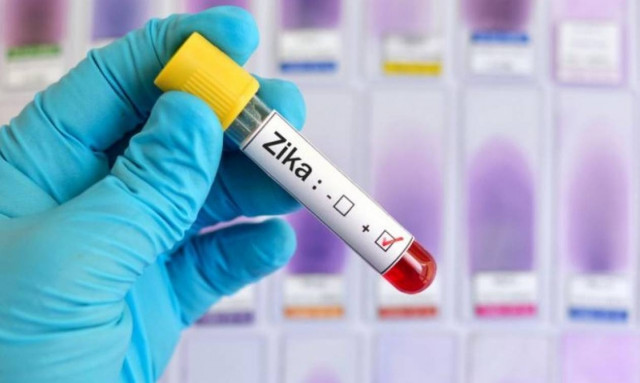 Σιγκαπούρη: 14 νέα περιστατικά μόλυνσης από τον ιό Ζίκα