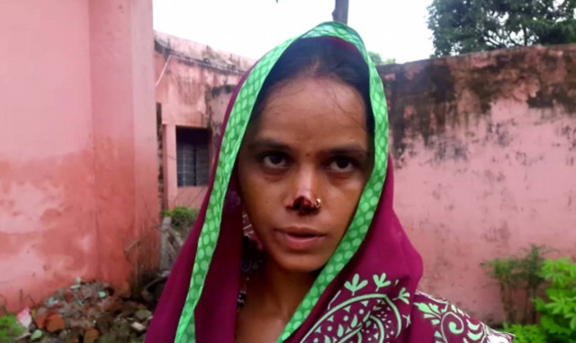 Φρίκη: Έκοψε τη μύτη της γυναίκας του επειδή δεν πήρε την προίκα που του έταξαν!