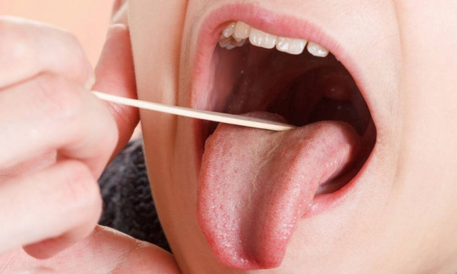 Απόστημα στις αμυγδαλές: Γιατί είναι απειλητικό για τη ζωή