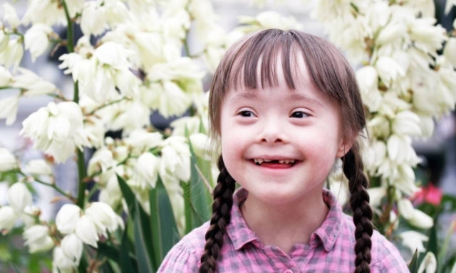 Θεσσαλονίκη: «Λουκέτο» βάζει  ο Σύλλογος Συνδρόμου Down Ελλάδος