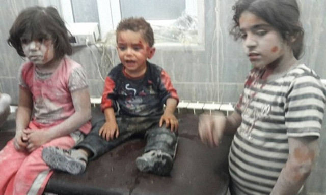 Θα σας ραγίσει την καρδιά: Τραυματισμένο παιδί στη Συρία γαντζώνεται πάνω σε νοσηλευτή (vid)