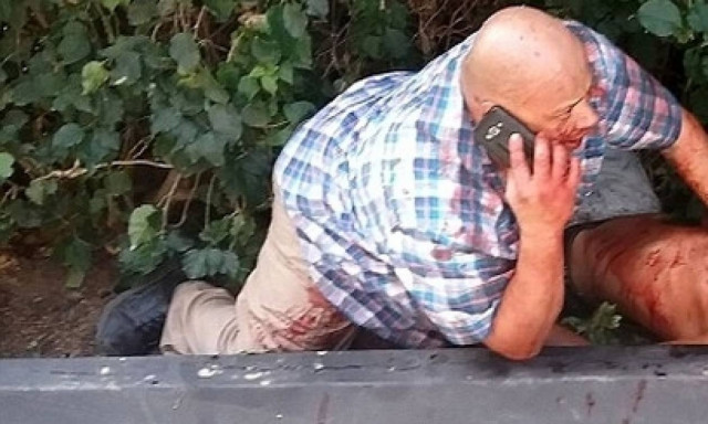 Σκληρή εικόνα: Μαχαίρωσαν το σωματοφύλακα διάσημου μοντέλου έξω από το σπίτι του