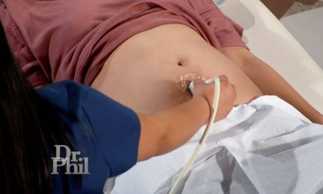 Νεαρή παρθένα υποστηρίζει ότι κυοφορεί τον Ιησού! Έπαθαν ακόμα μεγαλύτερο σοκ όταν είδαν τον υπέρηχο