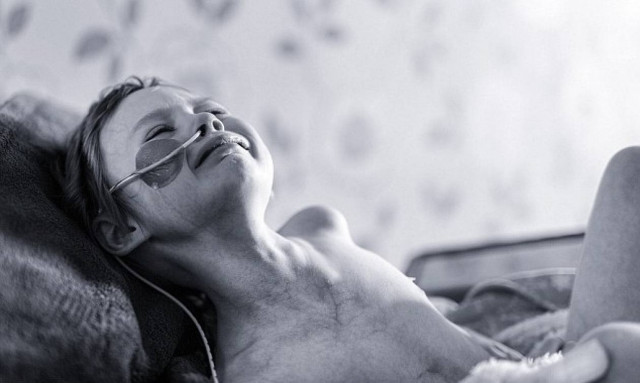 Πέθανε το αγγελούδι που ράγισε την καρδιά του κόσμου δείχνοντας το πρόσωπο του παιδικού καρκίνου