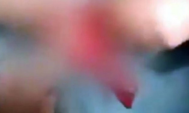 Το σεξουαλικό βίντεο που ανατρίχιασε το διαδίκτυο: Έβαλε μέσα στο πέος του ένα...