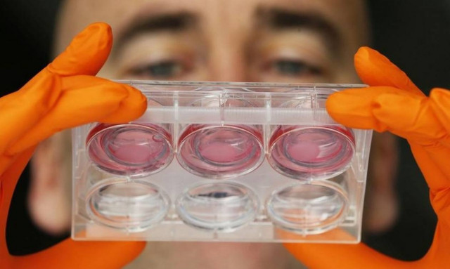 Δημιούργησαν για πρώτη φορά μίνι έντερα ανθρώπου με νεύρα!